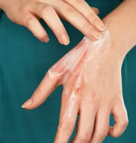 calamine-usp-img
